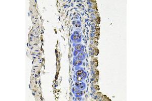 Immunohistochemistry of paraffin-embedded mouse lung using FLT1 antibody at dilution of 1:100 (x40 lens). (FLT1 anticorps)