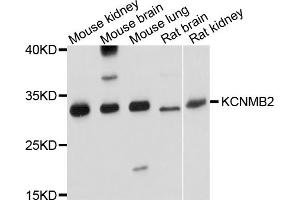 Western blot analysis of extracts of various cell lines, using KCNMB2 antibody. (KCNMB2 anticorps)