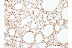 anti-RNA Binding Motif Protein 16 (RBM16) (C-Term) antibody