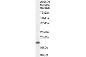 Image no. 1 for anti-Peptidylprolyl Cis/trans Isomerase, NIMA-Interacting 1 (PIN1) (Internal Region) antibody (ABIN374746) (PIN1 anticorps  (Internal Region))