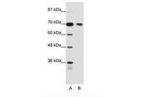 Image no. 1 for anti-Tripartite Motif Containing 32 (TRIM32) (N-Term) antibody (ABIN202853) (TRIM32 anticorps  (N-Term))