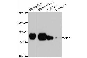 Western blot analysis of extracts of various cell lines, using AFP antibody. (alpha Fetoprotein anticorps)