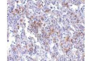 Immunohistochemistry of EVER1 in human spleen with EVER1 antibody at 2. (TMC6 anticorps  (Center))