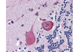 CBLN4 antibody was used for immunohistochemistry at a concentration of 4-8 ug/ml. (CBLN4 anticorps  (C-Term))