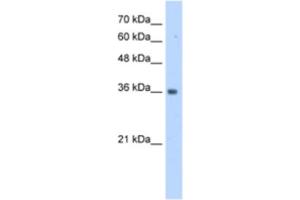 Western Blotting (WB) image for anti-TruB Pseudouridine (Psi) Synthase Homolog 2 (TRUB2) antibody (ABIN2463175) (TRUB2 anticorps)