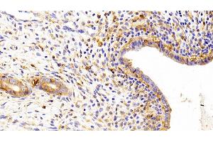 Detection of Kim1 in Rat Uterus Tissue using Polyclonal Antibody to Kidney Injury Molecule 1 (Kim1) (HAVCR1 anticorps  (AA 22-235))