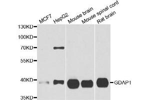 Western blot analysis of extracts of various cell lines, using GDAP1 antibody. (GDAP1 anticorps)