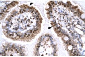 Rabbit Anti-EGR1 Antibody Catalog Number: ARP32241 Paraffin Embedded Tissue: Human Intestine Cellular Data: Epithelial cells of intestinal villas Antibody Concentration: 4. (EGR1 anticorps  (N-Term))