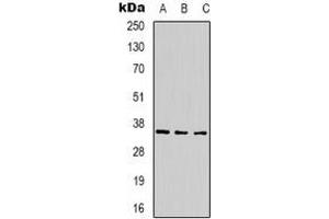 Western blot analysis of CABP2 expression in 293T (A), mouse brain (B), rat brain (C) whole cell lysates. (CABP2 anticorps)