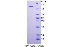 SDS-PAGE (SDS) image for Cytochrome P450, Family 26, Subfamily B, Polypeptide 1 (CYP26B1) (AA 1-512) protein (His tag) (ABIN1981144)