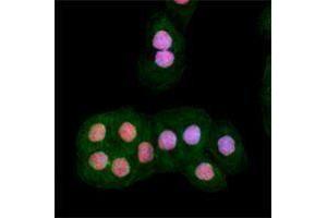 Immunofluorescence (IF) image for anti-Ataxia Telangiectasia Mutated (ATM) (phosphorylated) antibody (ABIN2666313) (ATM anticorps  (phosphorylated))