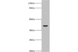 Western blot All lanes: Alcohol dehydrogenase 4 antibody at 2 μg/mL + Mouse liver tissue Secondary Goat polyclonal to rabbit IgG at 1/10000 dilution Predicted band size: 41, 43 kDa Observed band size: 41 kDa (ADH4 anticorps  (AA 1-380))