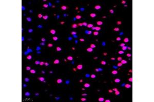 Immunofluorescence of paraffin embedded mouse brain using TCEAL3 (ABIN7075951) at dilution of 1:700 (400x lens)