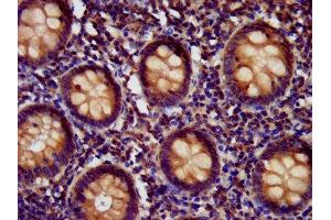 IHC image of ABIN7151786 diluted at 1:400 and staining in paraffin-embedded human appendix tissue performed on a Leica BondTM system. (EDC4 anticorps  (AA 753-952))
