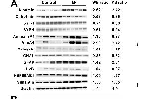 Western blot validation and IHC analysis of synaptophysin and synaptotagmin-1.