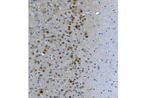 IHC analysis of LSM7 using anti-LSM7 antibody (ABIN7598937). (LSM7 anticorps  (AA 1-103))