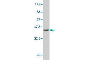 Western Blot detection against Immunogen (37.