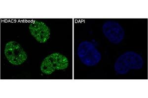 Immunofluorescent analysis of Hela cells, using HDAC9 Antibody.