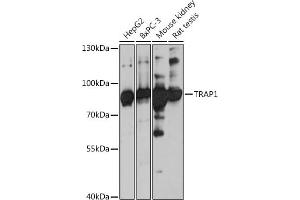 Western blot analysis of extracts of various cell lines, using TR antibody (ABIN1683134, ABIN5664756, ABIN5664758 and ABIN6220605) at 1:3000 dilution. (TRAP1 anticorps  (AA 445-704))