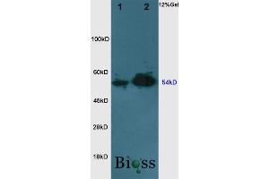 L1 rat brain, L2 rat liver lysates probed (ABIN727100) at 1:200 in 4 °C. (NAMPT anticorps  (AA 301-400))