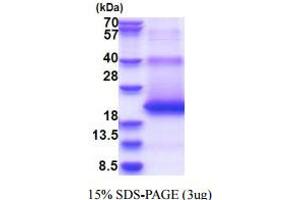 SDS-PAGE (SDS) image for Mannose-6-Phosphate Receptor (Cation Dependent) (M6PR) (AA 27-185) protein (His tag) (ABIN5853696)