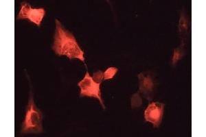 Immunofluorescence - anti-Venus Ab in 293HEK Cells with Venus Protein at 1/50 dilution, Cells were fixed With 4% of PFA