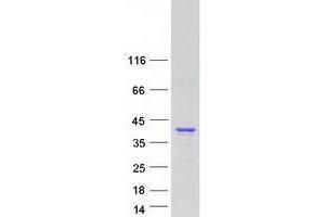 Validation with Western Blot