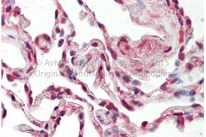 Rabbit Anti-SRSF9 antibody Catalog Number: ARP40490 Formalin Fixed Paraffin Embedded Tissue: Human Adult Lung  Observed Staining: Cytoplasm in hepatocytes Primary Antibody Concentration: 1:600 Secondary Antibody: Donkey anti-Rabbit-Cy3 Secondary Antibody Concentration: 1:200 Magnification: 20X Exposure Time: 0.