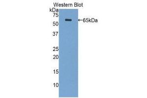 Western Blotting (WB) image for anti-Periplakin (PPL) (AA 1439-1716) antibody (ABIN1860293) (PPL anticorps  (AA 1439-1716))