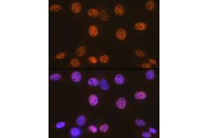 Immunofluorescence analysis of NIH-3T3 cells using SM/B Rabbit mAb  at dilution of 1:100 (40x lens).