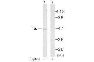 Image no. 1 for anti-Microtubule-Associated Protein tau (MAPT) (Ser235) antibody (ABIN197261) (MAPT anticorps  (Ser235))