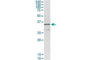 CENPH MaxPab rabbit polyclonal antibody. (CENPH anticorps  (AA 1-247))