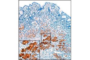 Immunohistochemistry (IHC) image for anti-Pepsinogen A antibody (ABIN108409) (Pepsinogen A anticorps)