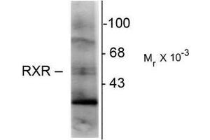 Western Blotting (WB) image for anti-Retinoid X Receptor, gamma (RXRG) (Hinge Region) antibody (ABIN371840) (Retinoid X Receptor gamma anticorps  (Hinge Region))
