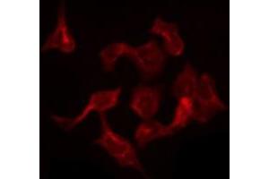 ABIN6275696 staining LOVO by IF/ICC.