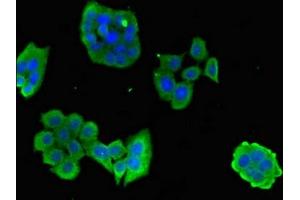 Immunofluorescent analysis of PC-3 cells using ABIN7146768 at dilution of 1:100 and Alexa Fluor 488-congugated AffiniPure Goat Anti-Rabbit IgG(H+L)
