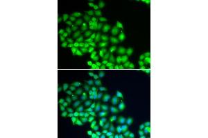 Immunofluorescence analysis of HeLa cells using XPD/XPD/ERCC2 antibody (ABIN6130301, ABIN6140265, ABIN6140266 and ABIN6221277). (ERCC2 anticorps  (AA 1-300))
