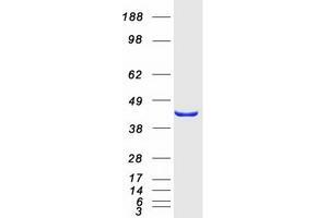 Validation with Western Blot