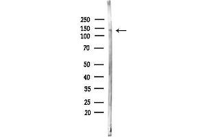 Western blot analysis of lysates from PC12 cells(UV,30 min treatment), using STIL Antibody at 1/1000 dilution.