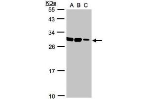 WB Image Sample(30 ug whole cell lysate) A:HeLa S3, B:Hep G2 , C:MOLT4 , 12% SDS PAGE antibody diluted at 1:1000 (ASB9 anticorps)