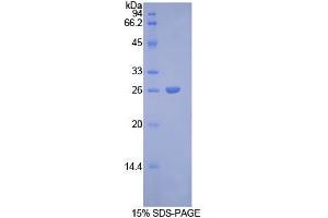 SDS-PAGE analysis of Rat Connexin 43 Protein. (Connexin 43/GJA1 Protéine)