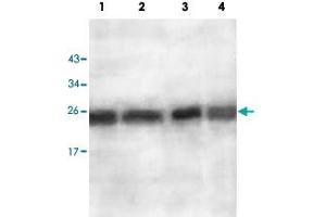 Western blot analysis of ES2 cell (Lane 1), EC109 cell (Lane 2), human fetal lung (Lane 3) and human fetal brain (Lane 4) lysate with AKR1A1 polyclonal antibody  at 1 : 500 dilution. (AKR1A1 anticorps  (AA 132-310))