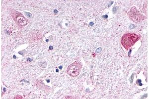 Anti-NR1D1 antibody  ABIN1049129 IHC staining of human brain, thalamus. (NR1D1 anticorps  (Internal Region))