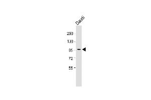 Anti-INB Antibody (C-term) at 1:1000 dilution + Daudi whole cell lysate Lysates/proteins at 20 μg per lane. (INPP5B anticorps  (C-Term))