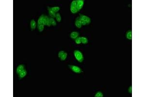 Immunofluorescent analysis of HepG2 cells using ABIN7154802 at dilution of 1:100 and Alexa Fluor 488-congugated AffiniPure Goat Anti-Rabbit IgG(H+L) (NHP2 anticorps  (AA 1-153))