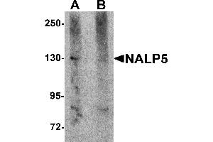Western Blotting (WB) image for anti-NLR Family, Pyrin Domain Containing 5 (NLRP5) (C-Term) antibody (ABIN1030533) (NLRP5 anticorps  (C-Term))