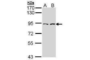 WB Image Sample (30 ug of whole cell lysate) A: Hela B: Hep G2 , 7. (CTNNAL1 anticorps  (Internal Region))