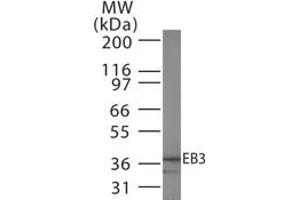 Western Blotting (WB) image for anti-Microtubule-Associated Protein, RP/EB Family, Member 3 (MAPRE3) antibody (ABIN208429) (MAPRE3 anticorps)