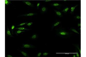 Immunofluorescence of monoclonal antibody to DDB1 on HeLa cell.