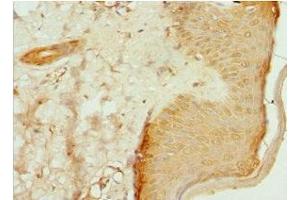 Immunohistochemistry of paraffin-embedded human skin tissue using ABIN7147369 at dilution of 1:100